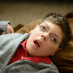 儿童癫痫症状分类 儿童癫痫症状分类